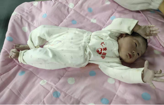 胎兒臍帶繞頸3周，醫(yī)生助力成功生產(chǎn)