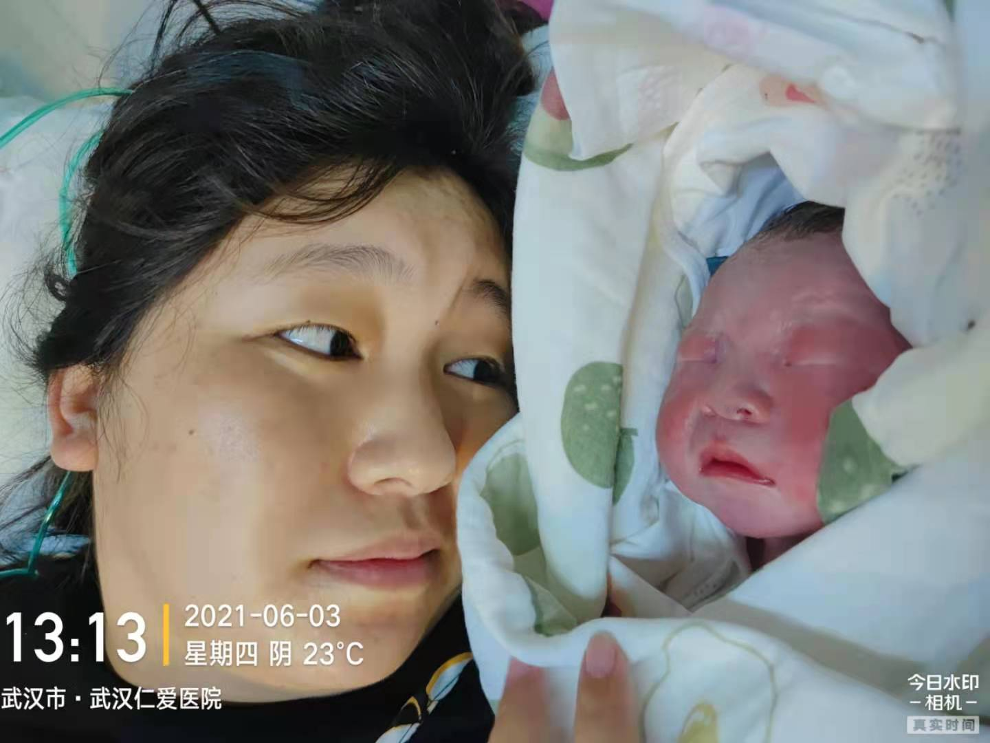 瘢痕子宮順產(chǎn)，圓媽媽順產(chǎn)夢(mèng)